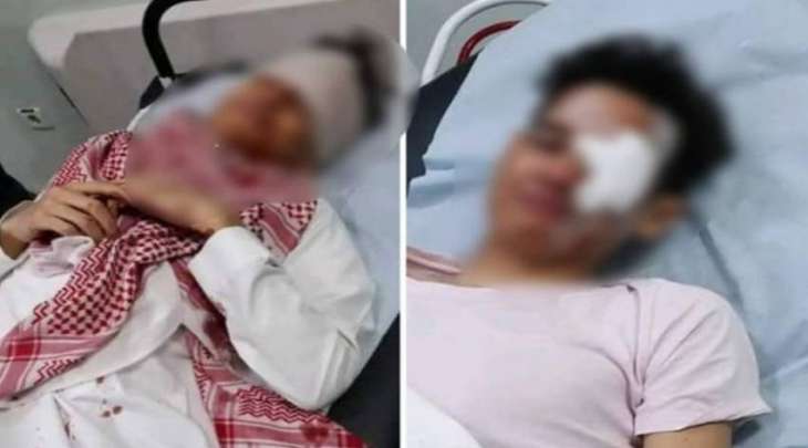 اصابة طالب مصري فی عینہ أثناء مشاجرة داخل مدرسة فی مدینة بریدة