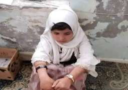 طفلة یمنیة تتعرض للاعتداء بالضرب علی ید والدھا قبل بیعھا کجاریة بمبلغ قلیل