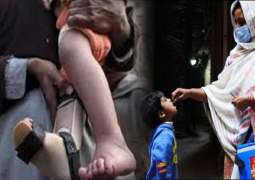 وزارة الصحة تعلن ظھور أول حالة شلل الأطفال في العام الجاري