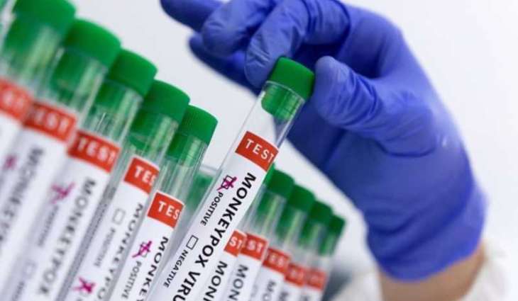 Sierra Leone confirms first Mpox case