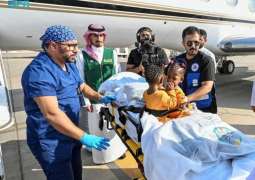إنفاذًا لتوجيهات خادم الحرمين الشريفين وسمو ولي العهد.. وصول التوأم الملتصق الجامايكي 