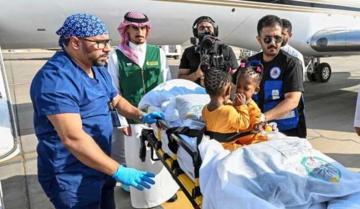 إنفاذًا لتوجيهات خادم الحرمين الشريفين وسمو ولي العهد.. وصول التوأم الملتصق الجامايكي 