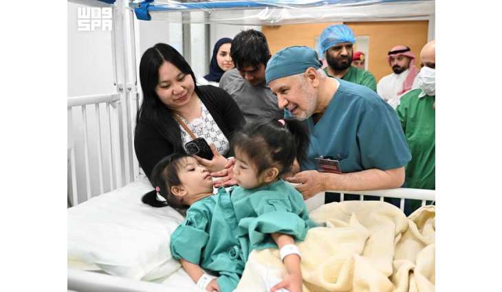 إنفاذًا لتوجيهات خادم الحرمين الشريفين وسمو ولي العهد.. بدء عملية فصل التوأم الملتصق الفلبيني (أوليفيا وجيانا)
