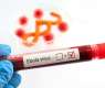 First Ebola patient in France recovers