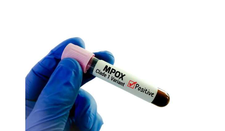 Madagascar mpox cases top 3,000 since outbreak in December 2025